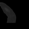 SPORK, NICO - 22.03.1976 - 02.08.2022 - CT obere Extremität - 18:01:46
